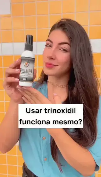 aminexidil